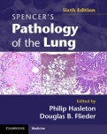 Spencer"s Pathology of the Lung 2 Part Set