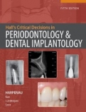 HALL"S CRITICAL DECISIONS IN PERIODONTOLOGY <b>*OFERTA* </b>